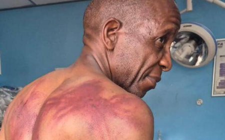 Opposition Leader Lovemore Madhuku Attacked by Masked Men at Party Meeting