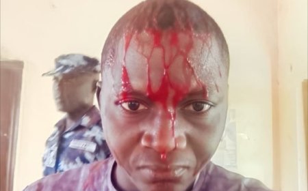 Nigerian Journalist Assaulted by Police, Media Rights Group Demands Justice