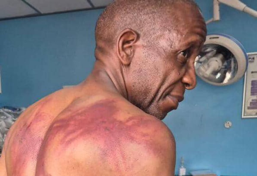 Opposition Leader Lovemore Madhuku Attacked by Masked Men at Party Meeting