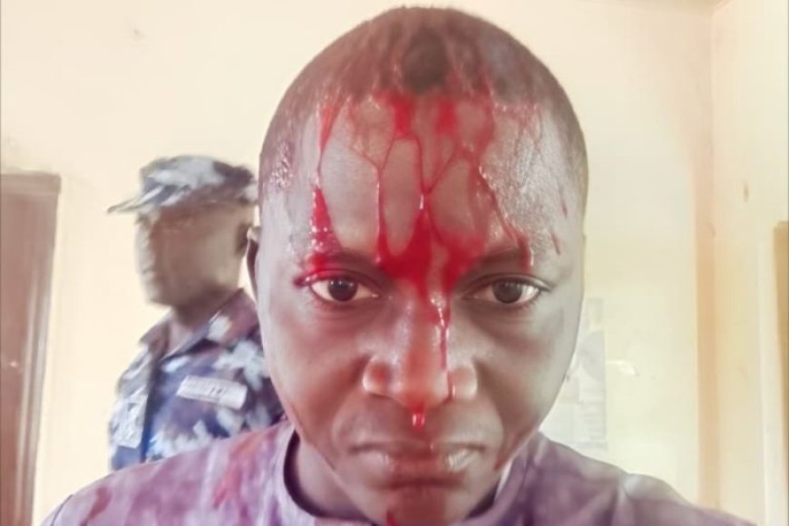Nigerian Journalist Assaulted by Police, Media Rights Group Demands Justice