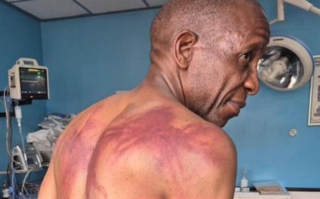 Opposition Leader Lovemore Madhuku Attacked by Masked Men at Party Meeting